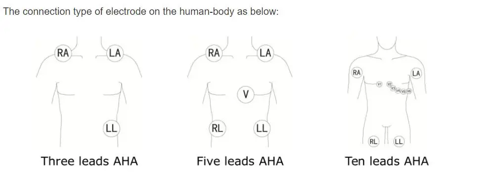 5-Lead EKG leadwires untuk philips digitrak plus 24 jam holter 3100A, 5-lead, Snap